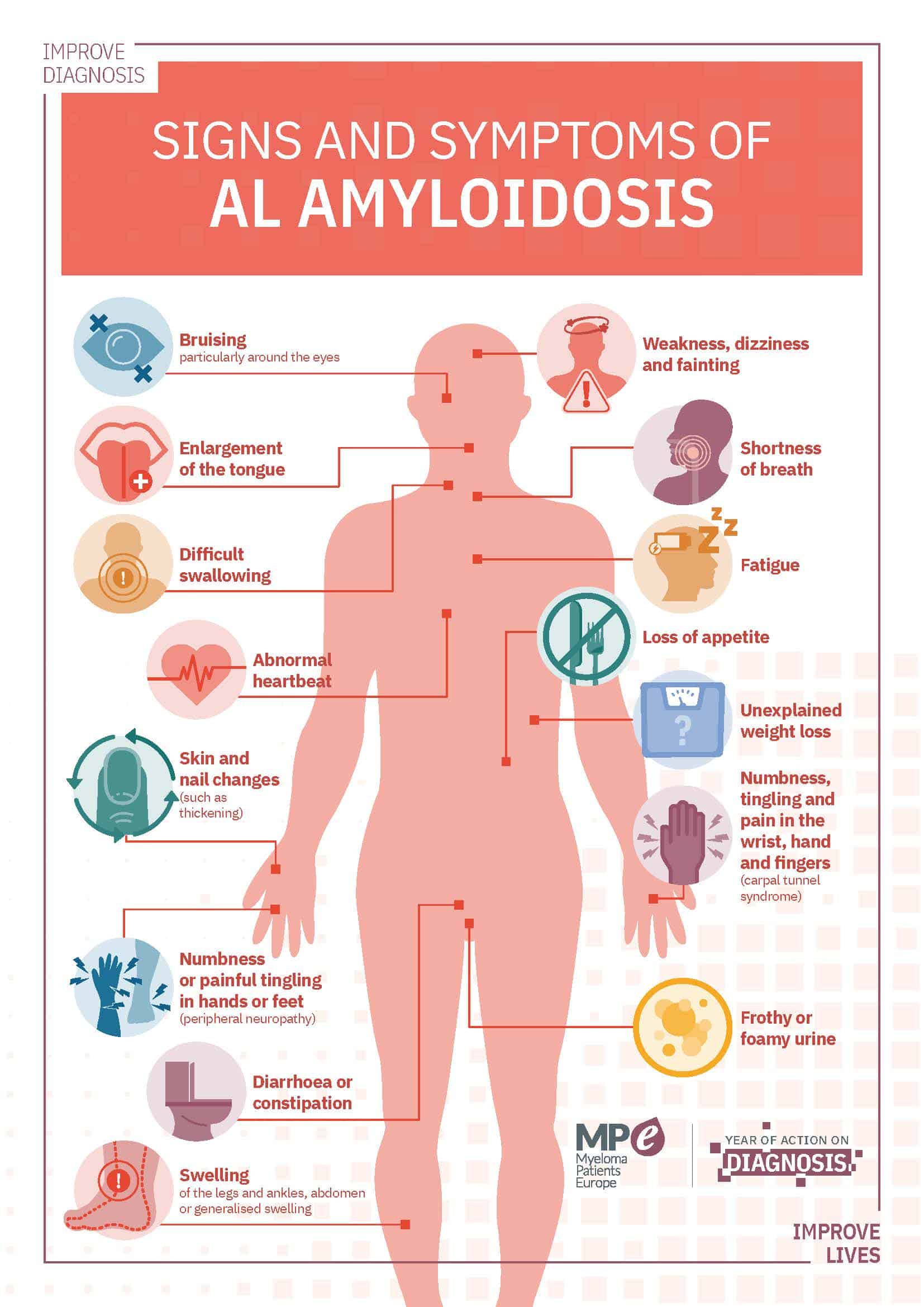 Signs and symptoms of AL amyloidosis
