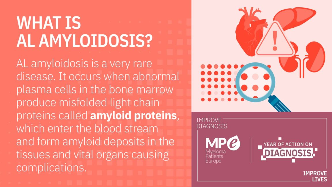 AL amyloidosis infographics - Myeloma Patients Europe