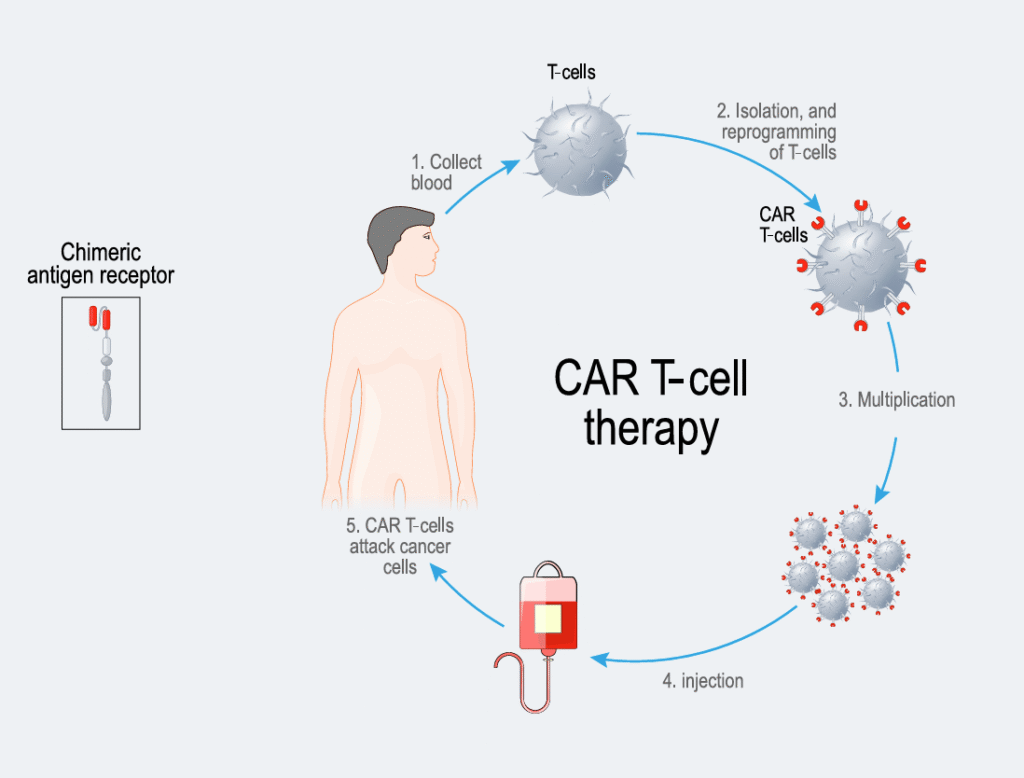 CAR T- cell therapy process